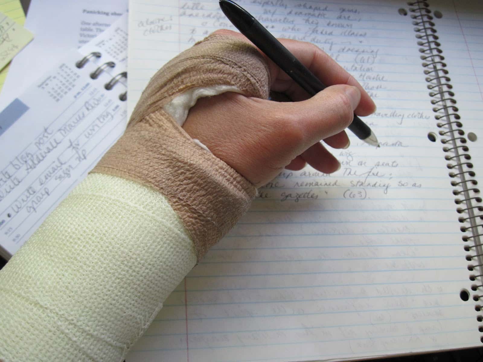 broken-hand-in-cast-1526980561733.jpg