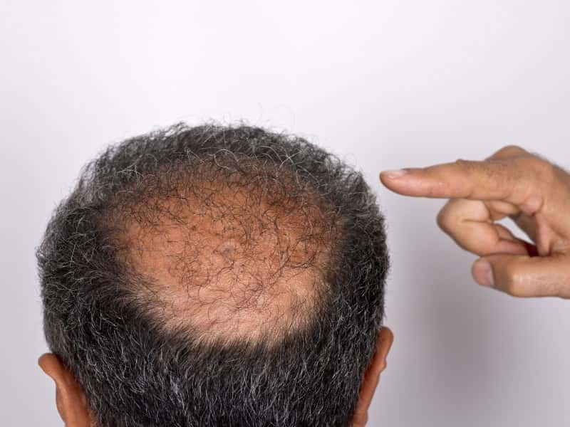 tattoo_bald-1537911919512.jpg