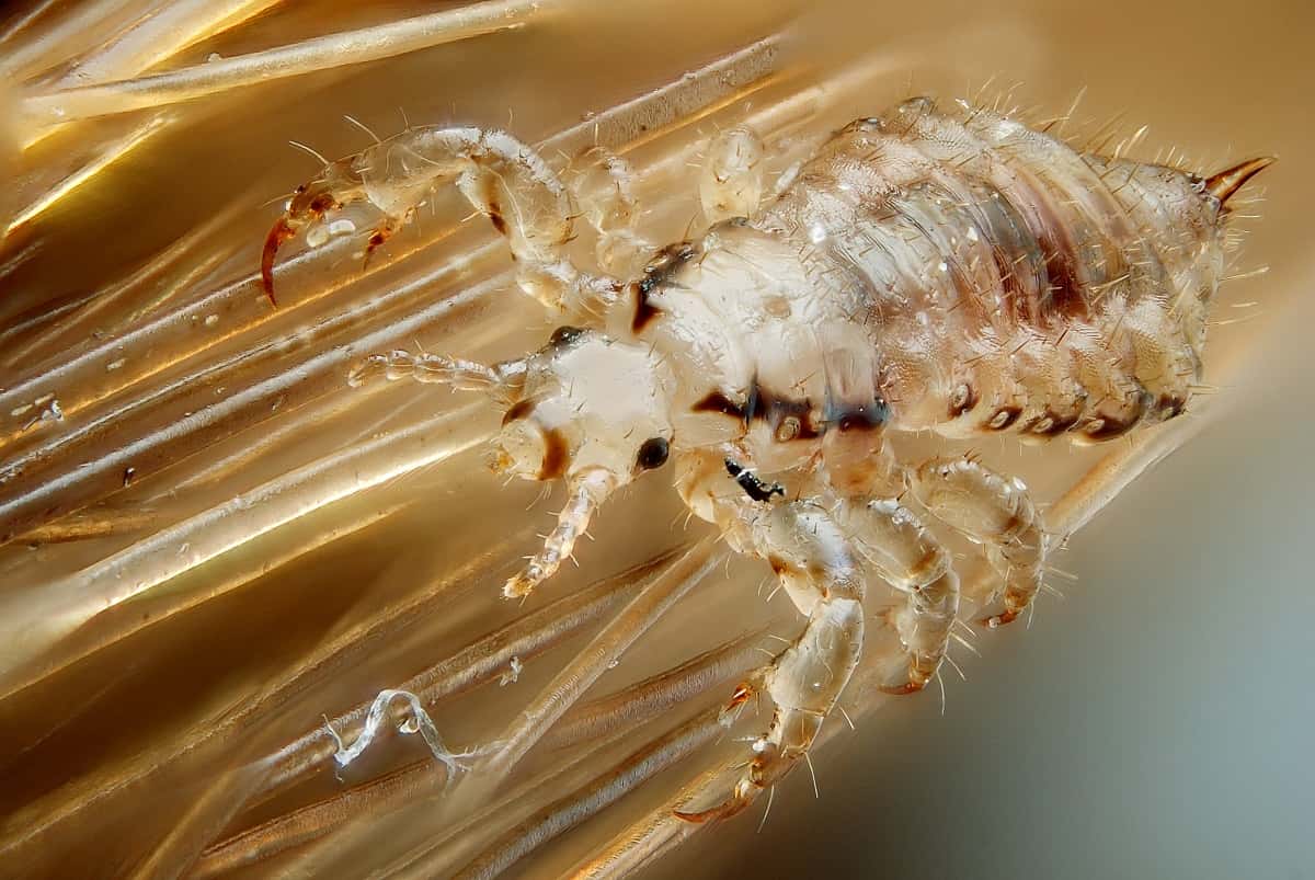 male_human_head_louse-1549406011414.jpg