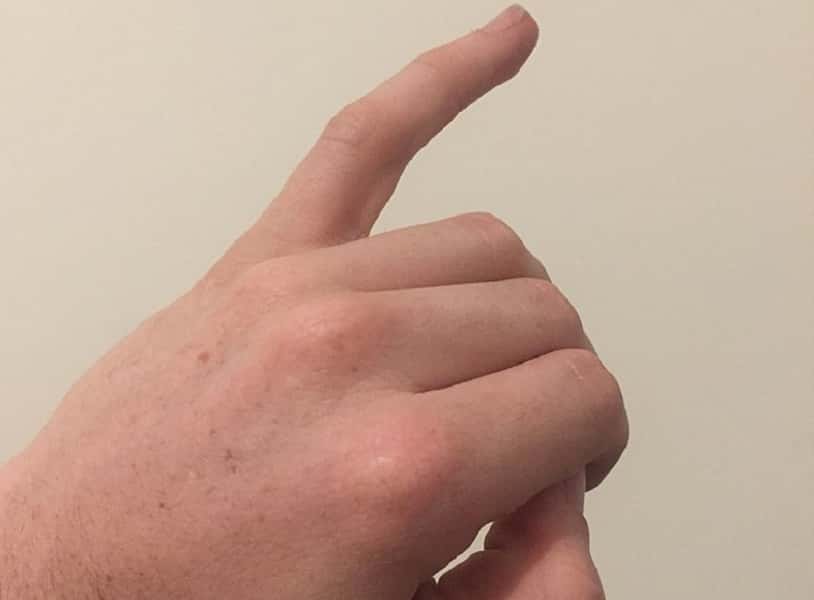768px-little_pinky_finger-1561466078072.jpg