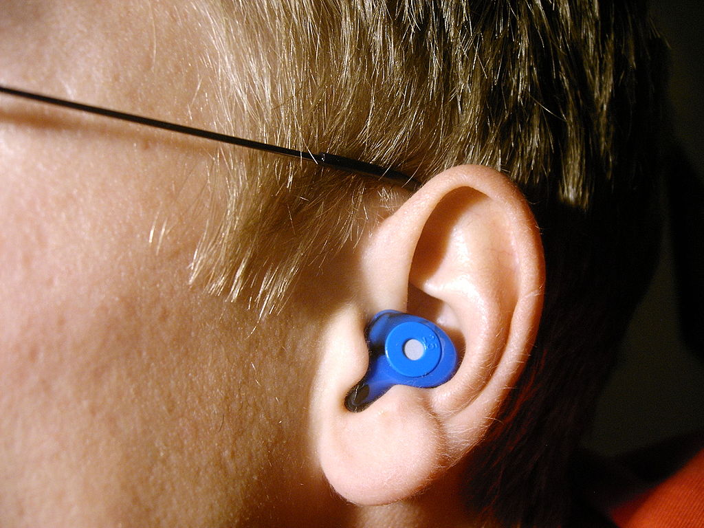 1024px-elacin_-r-_er-25_-_musician_earplug_worn-1556881675504.JPG