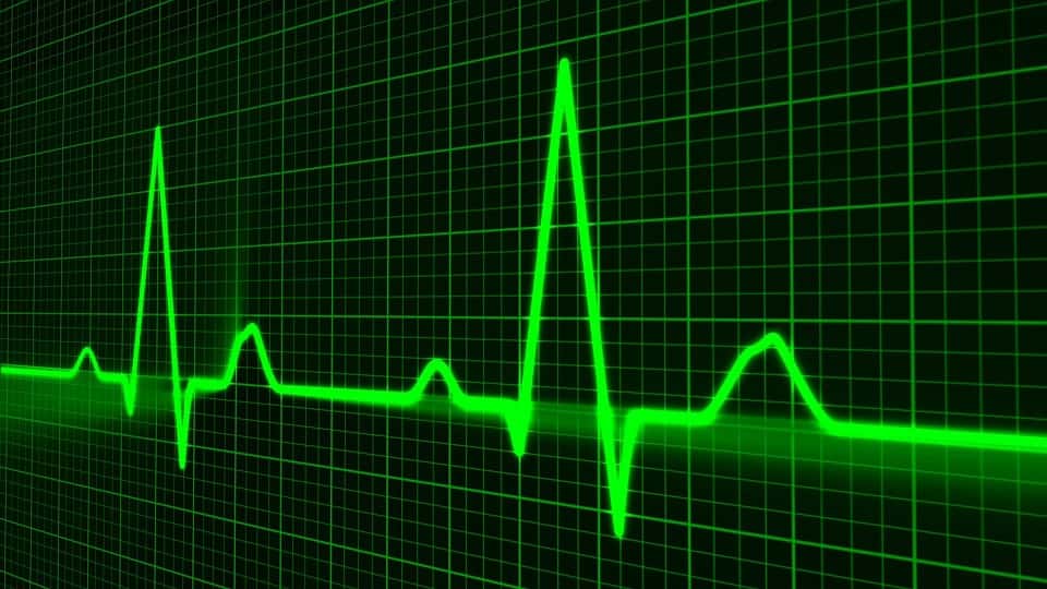 pulse-trace-163708_960_720
