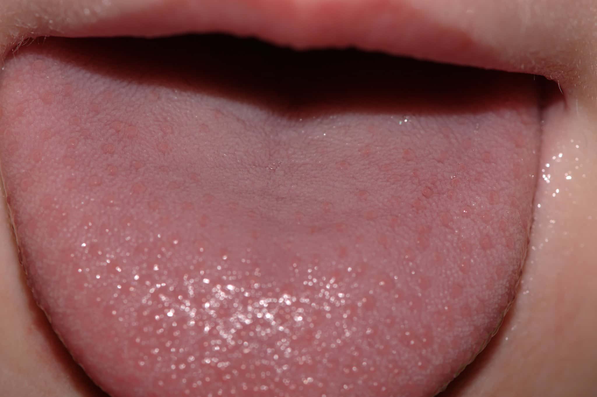 8082681189_9f101519ce_k