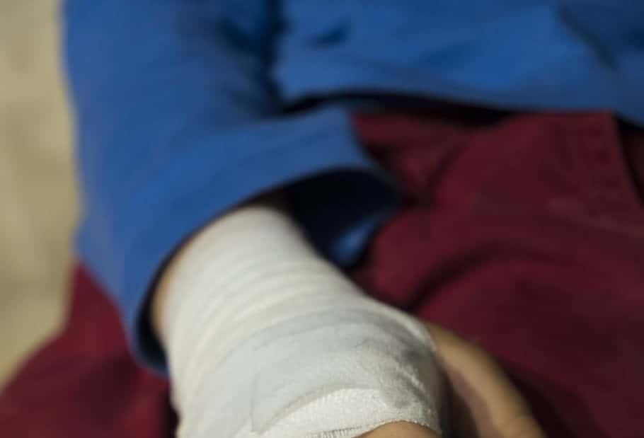 child-boy-injury-injured