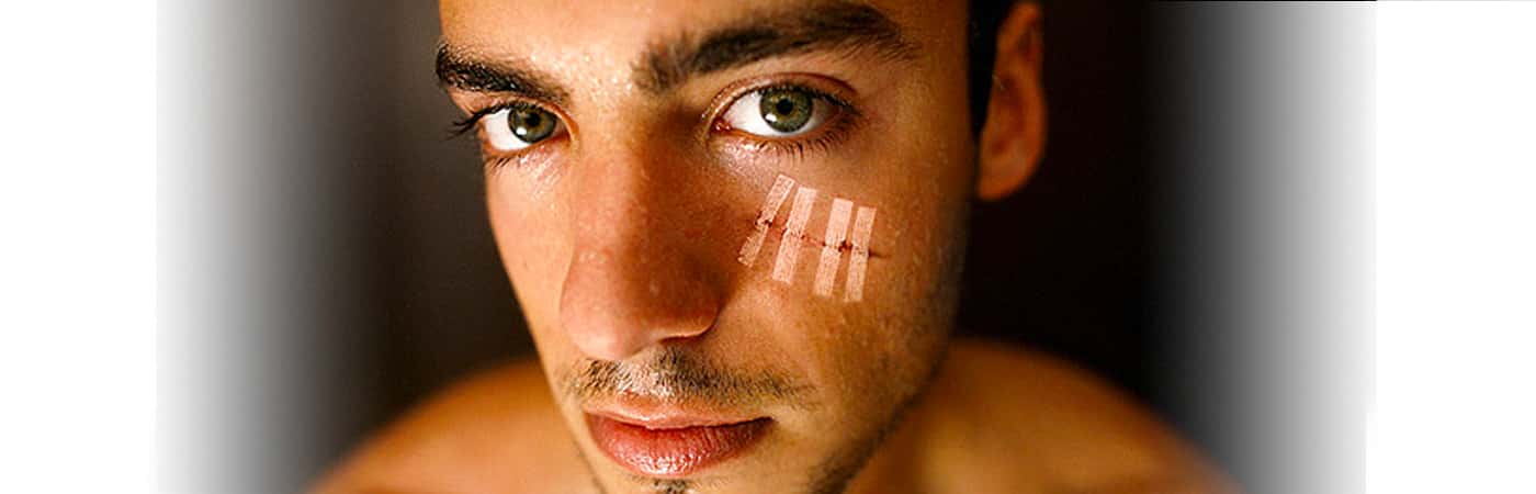 People Share The Painful Stories Behind Their Scars