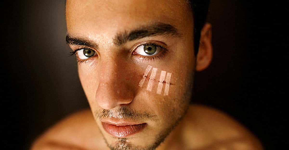 People Share The Painful Stories Behind Their Scars