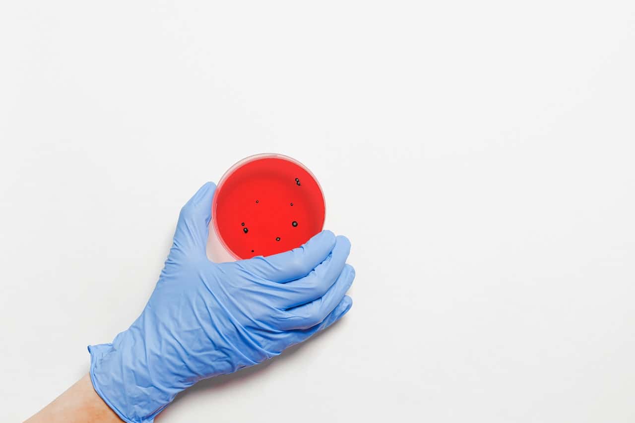 hand-holding-petri-dish-3786245